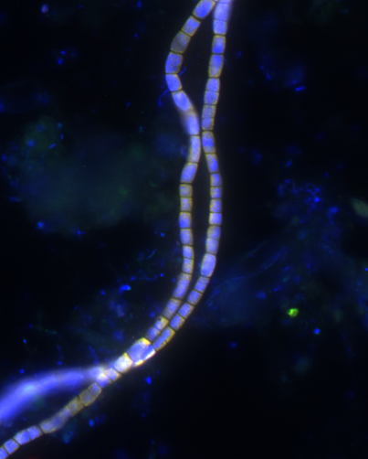 Cable bacteria